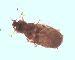 250px-Pemphigus-spirothecae_under_microscope_sexupara.jpg